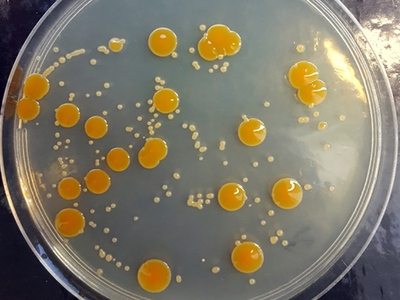 Colonies of P. halocryophilus grown under perchlorate stress conditions look smaller and paler than normal colonies—but they’re still alive. 