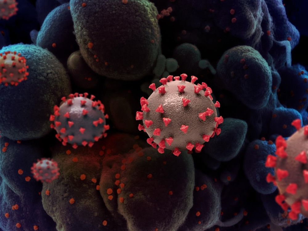 An artistic representation of SARS-CoV-2, the virus that causes COVID-19. (NIAID)