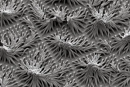Polymer fronds a few thousand nanometers long wrap around even tinier plymer spheres.