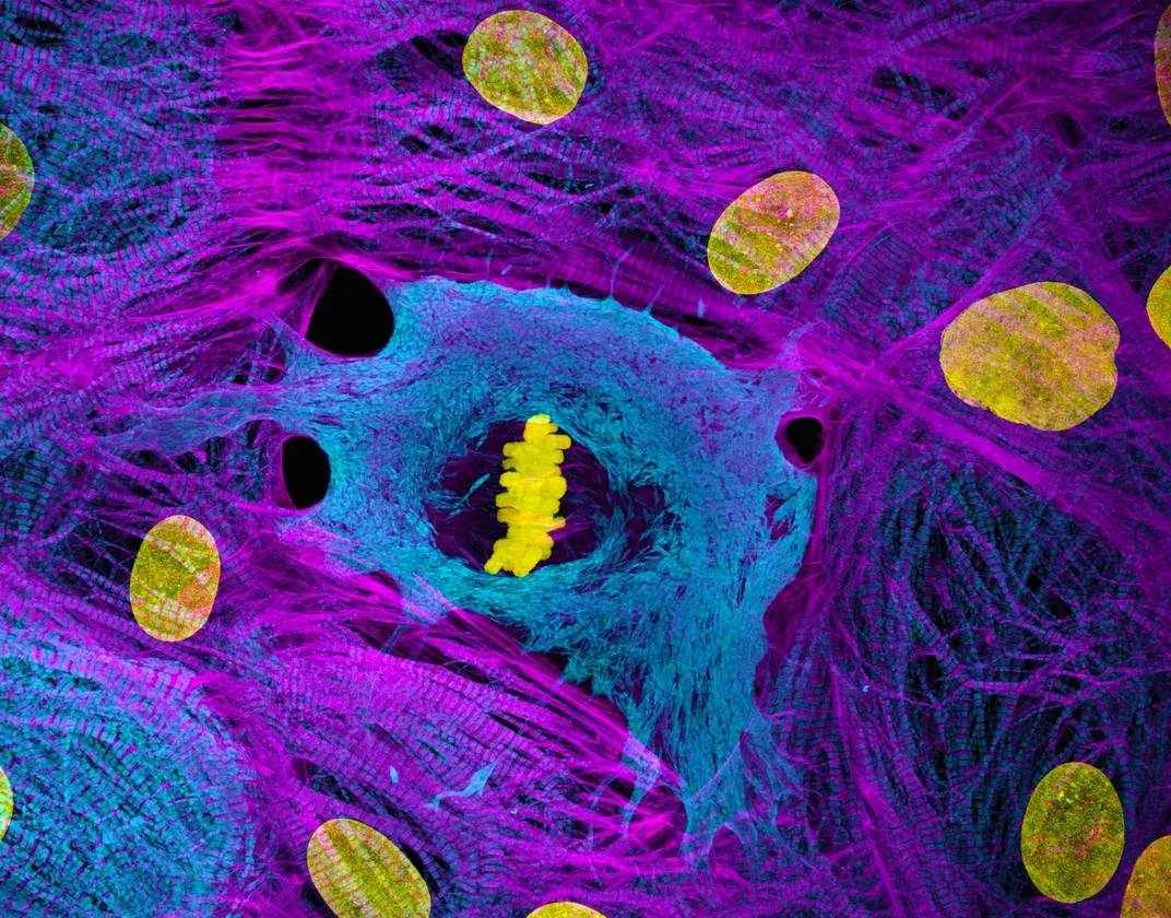 blue and purple stringy material with yellow objects