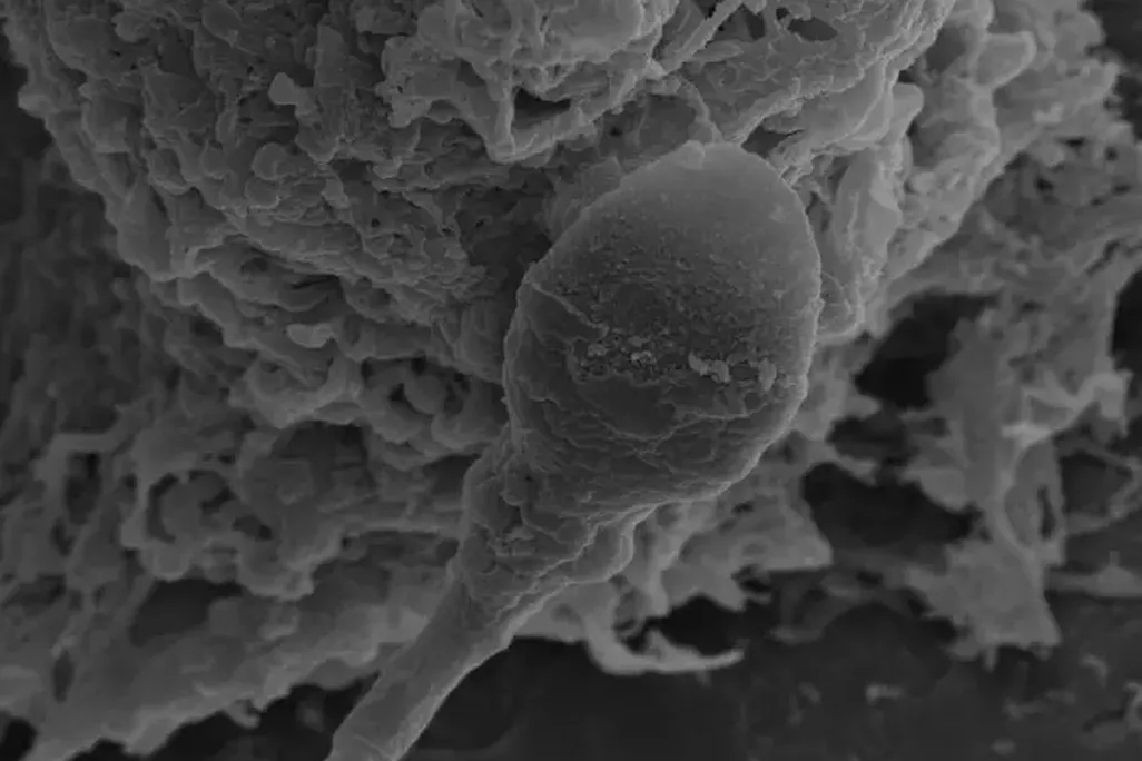 a close up of what looks like a sperm cell
