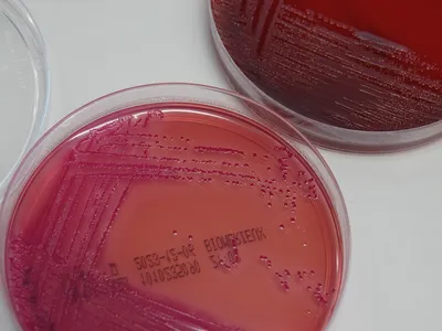 A petri dish with bacteria from a stool sample. The researchers found a number of bacteria, fungi and viruses in fecal samples from children that were altered in children with autism.