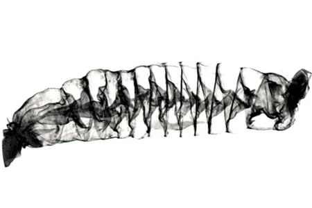 A CT scan of the spiral intestine of a Pacific spiny dogfish shark (Squalus suckleyi). The organ begins on the left and ends on the right.