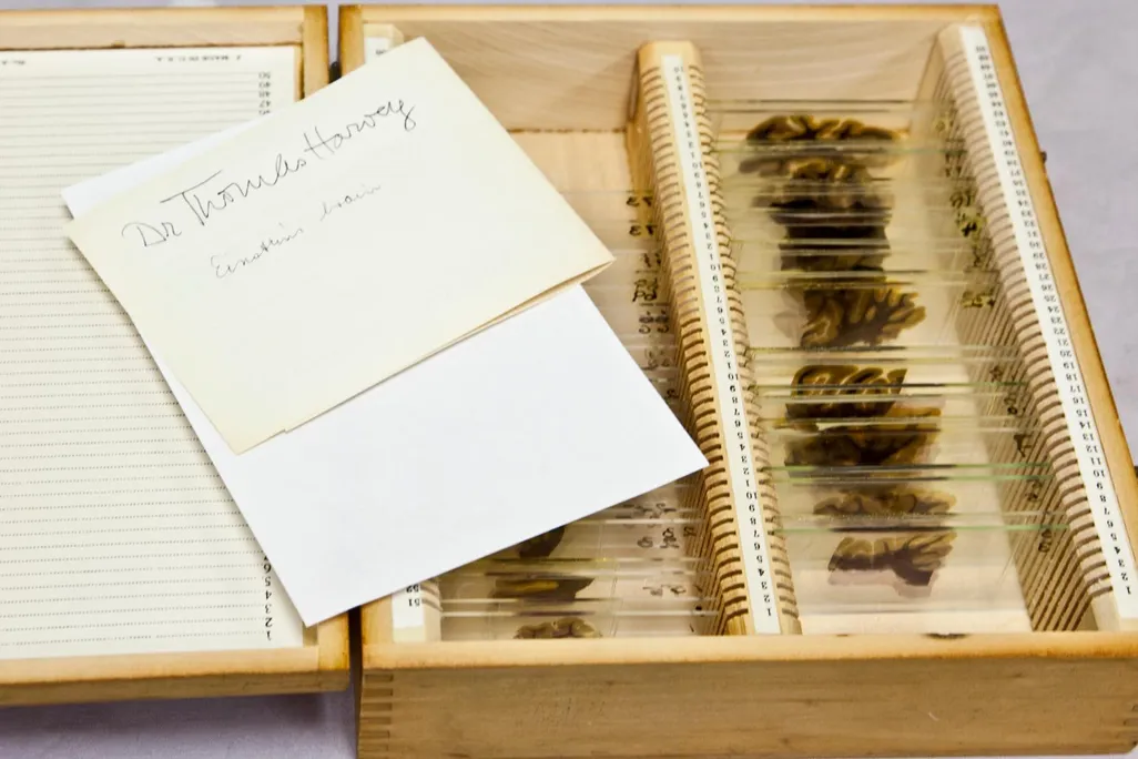 The box and slides that hold the brain of Einstein