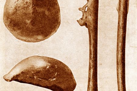 Eugene Dubois discovered the first hominid fossils in Indonesia when he unearthed Homo erectus bones at Trinil in 1891 and 1892.