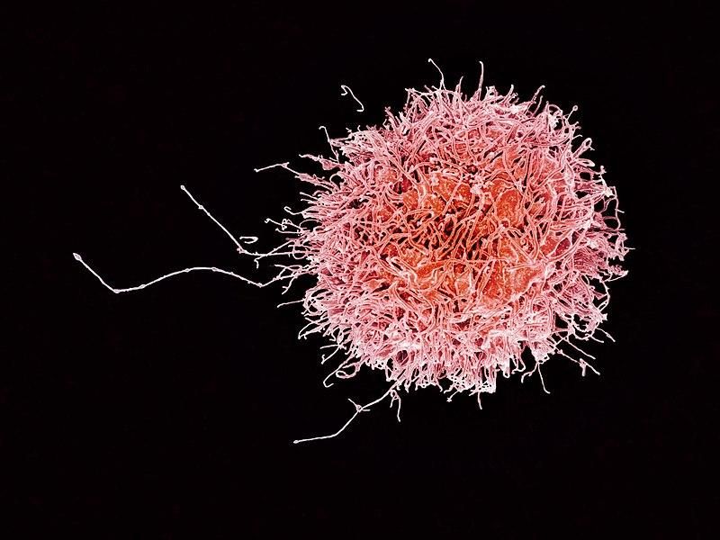 Human Cell Atlas