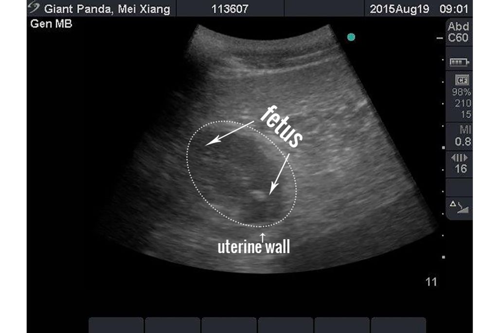 Mei Xiang's ultrasound