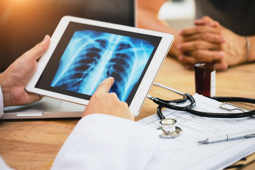 Doctor looking at x-ray scan of lungs with patient