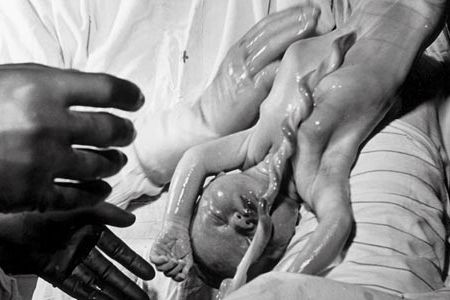 Newborn David B. Miller had the company of his mother (covered by sheets), grandfather (masked) and photographer father.