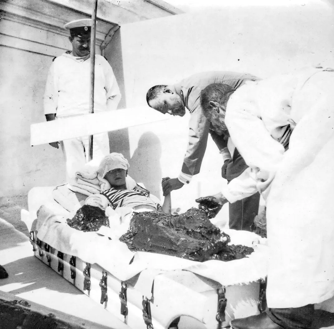 Alexei receives a mudbath treatment intended to treat his hemophilia in 1913.