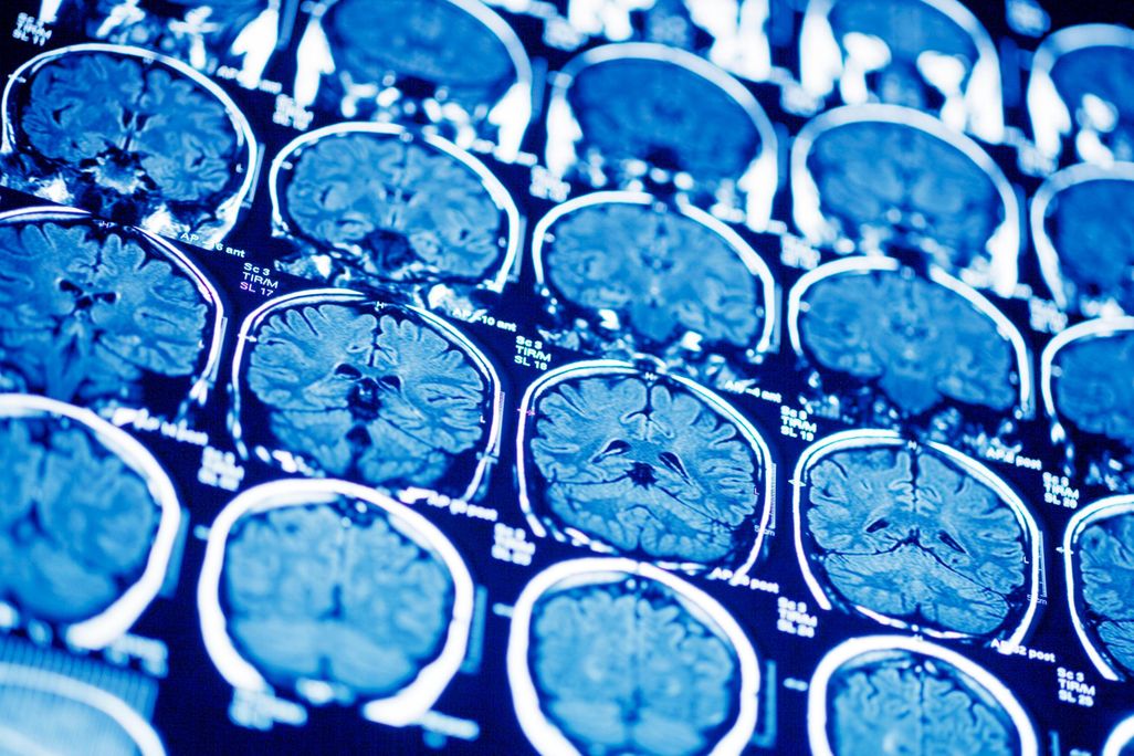 Brains
