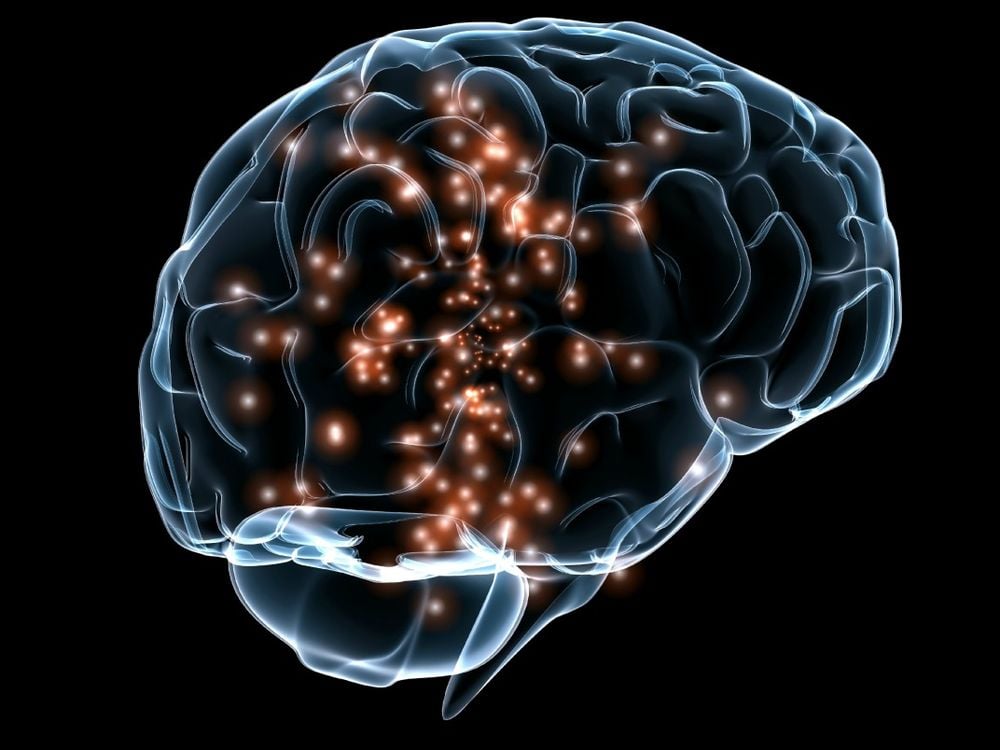 Darpa brain image