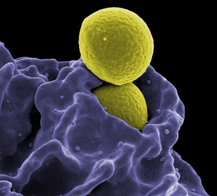 MRSA