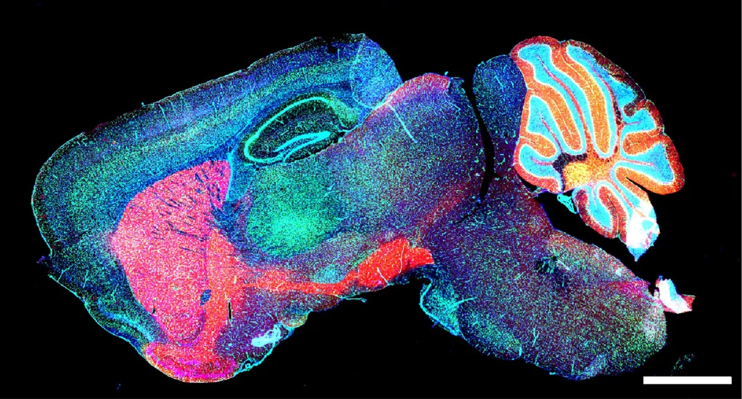 A microscopic image of a mouse brain its neurons.