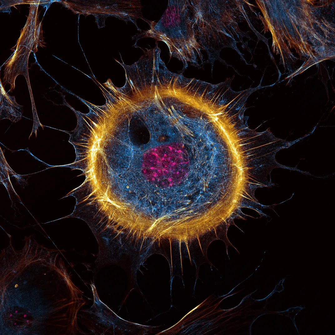 a spherical cell with an orange perimeter and blue interior with pink at the center