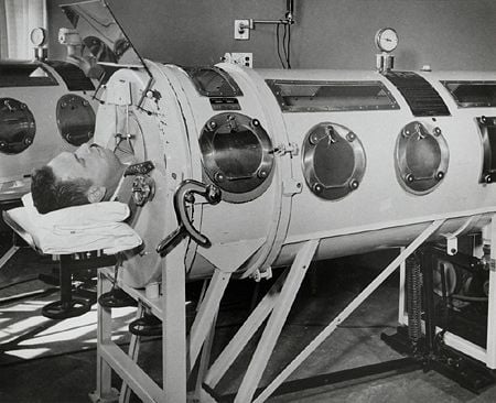 What Is an Iron Lung, and How Does It Work?