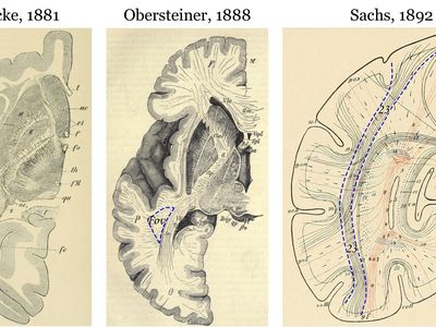 Early images of the vertical occipital fasciculus, a brain region involved in processing visual information