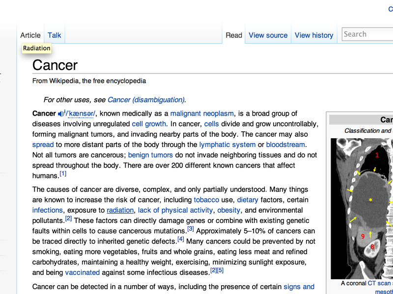 Chemotherapy - Wikipedia