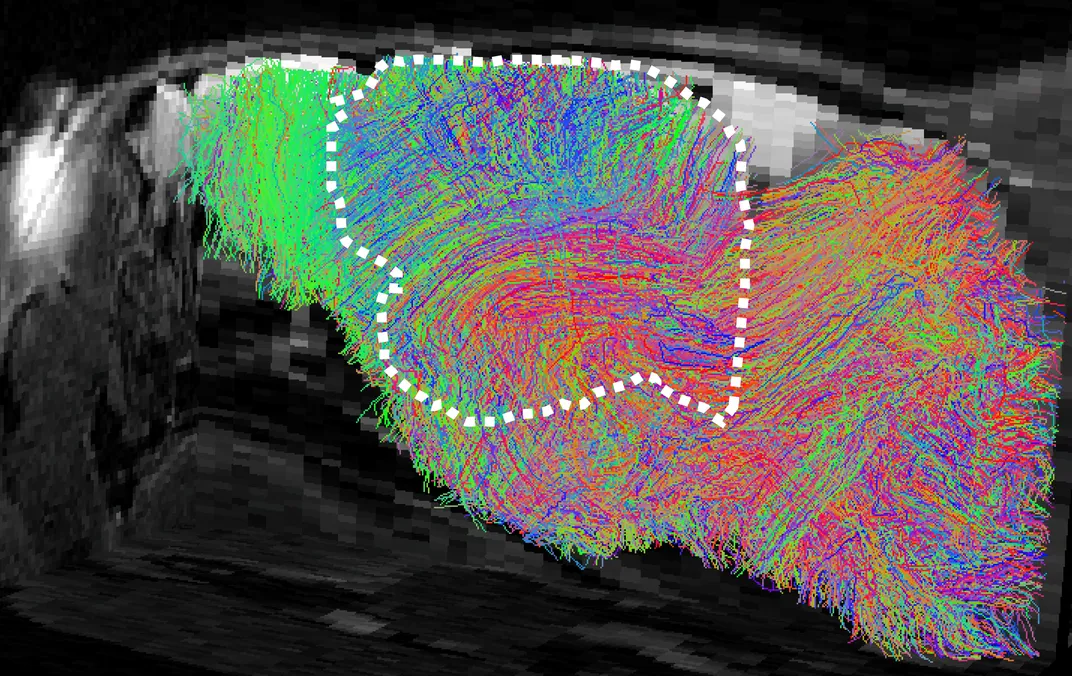 side view of mouse brain