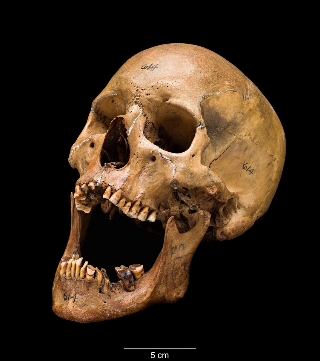 Human skull