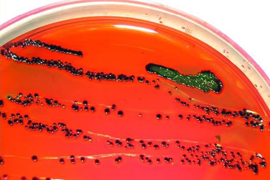 A close-up shot of E. coli growing on a petri dish. The dish has a bright red solution in it, and the bacteria looks like small green beads clustered together.