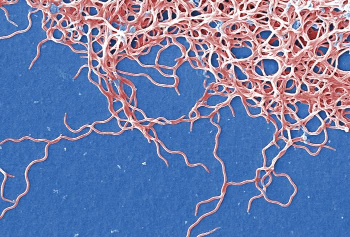 A digitally colorized image of Borrelia burgdorferi from a scanning electron microscope. The bacteria looks like a pile of pink string in front of a blue background.