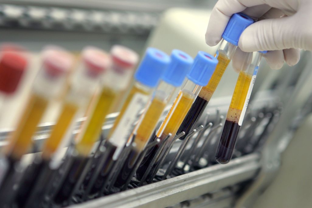 A row of blood samples in vials
