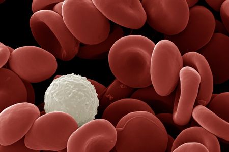 A scanning electron micrograph image of red and white blood cells.