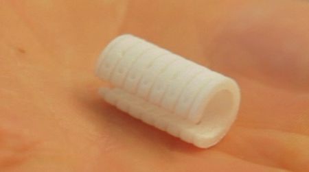 Engineers and doctors 3D printed this custom-made splint that currently holds open the airway of a six-week-old infant and will be gradually absorbed into the body over time.