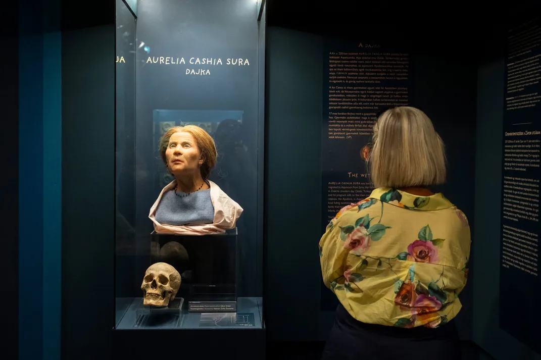 Woman looks at facial reconstruction