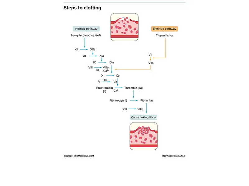 Blood Clot Graphic