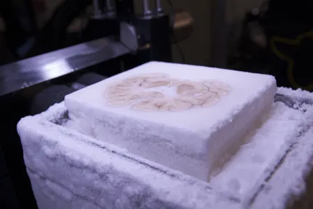 The frozen brain of famous memory patient H.M., shown during the slicing process.
