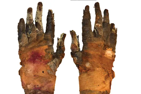 Swedish researchers used phase-contrast imaging to examine the soft tissue of a 2,400-year-old mummified hand