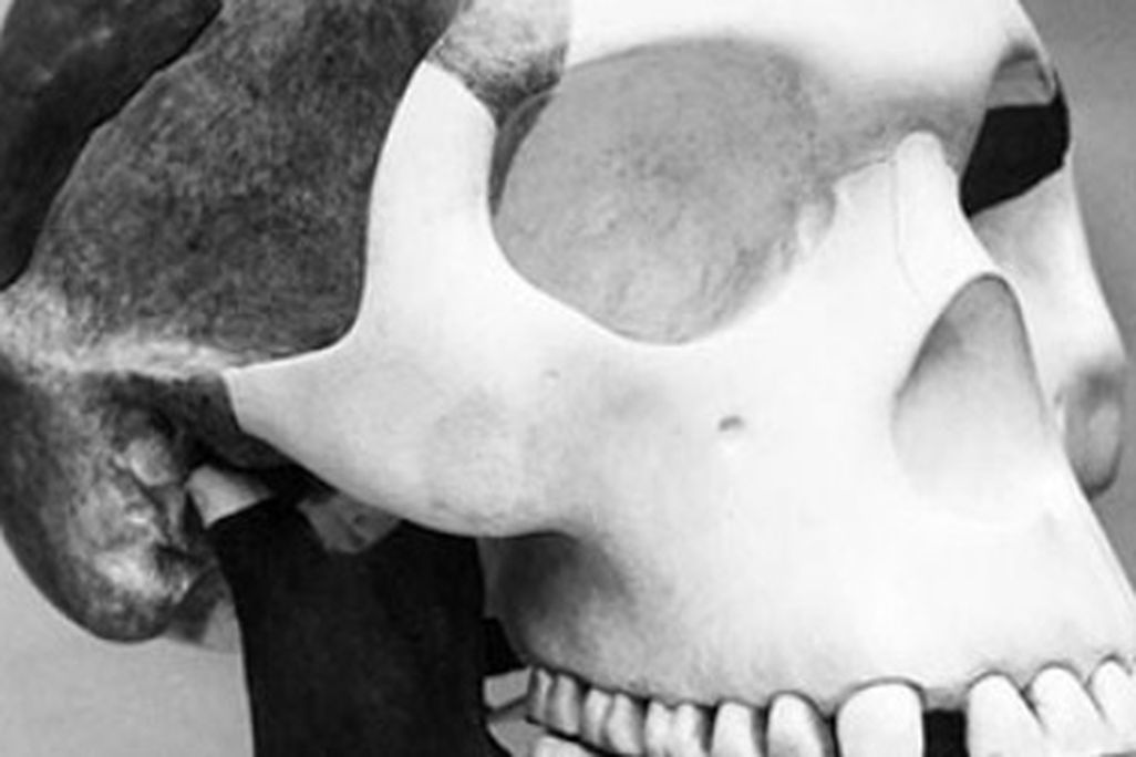 This is the story of a missing link that never was.