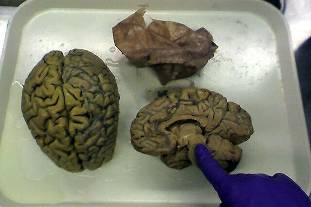 2012082310300608_23_2012_brain-half.jpg
