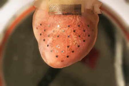 This "heart sock" is dotted with sensors that can detect the intricate inner workings of the heart. 
