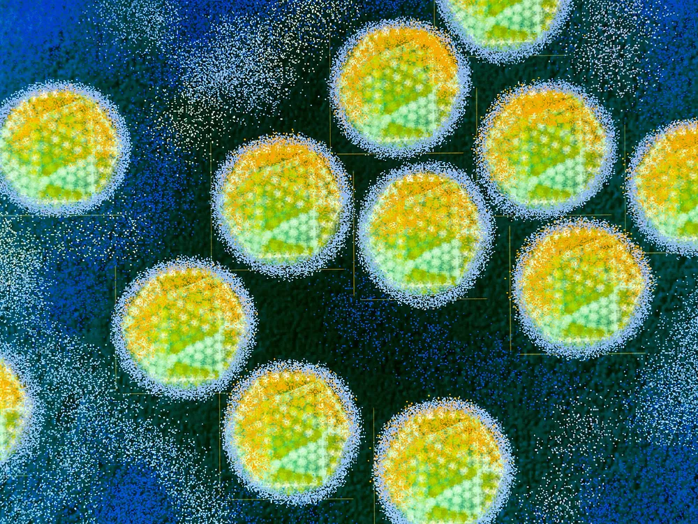 Green and yellow color-enhanced close-ups of adenovirus