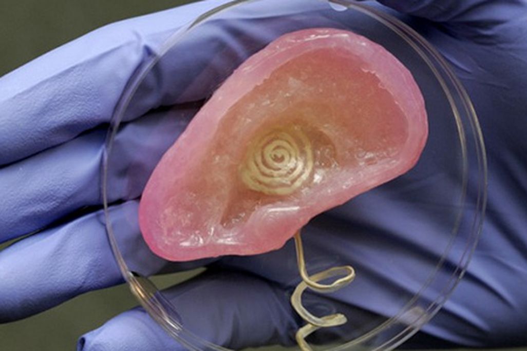 Bionic ear