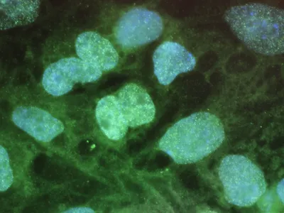 An image of stem cells on a computer screen from 2010. Stem cells have the potential to develop into various types of cells.