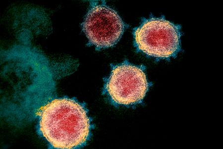 Electron microscope image of SARS-CoV-2, the virus that causes COVID-19, isolated from a patient in the United States.