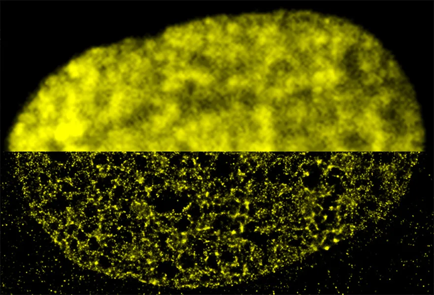 Fibroblast Nucleus