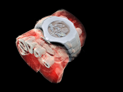 A human wrist (and wristwatch) imaged with the new 3D, color x-ray machine developed by MARS Bioimaging.