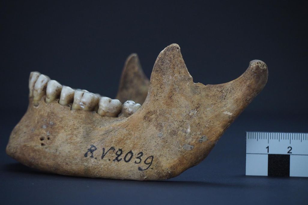 A photograph of human remains, a lower jawbone labeled RV 2039
