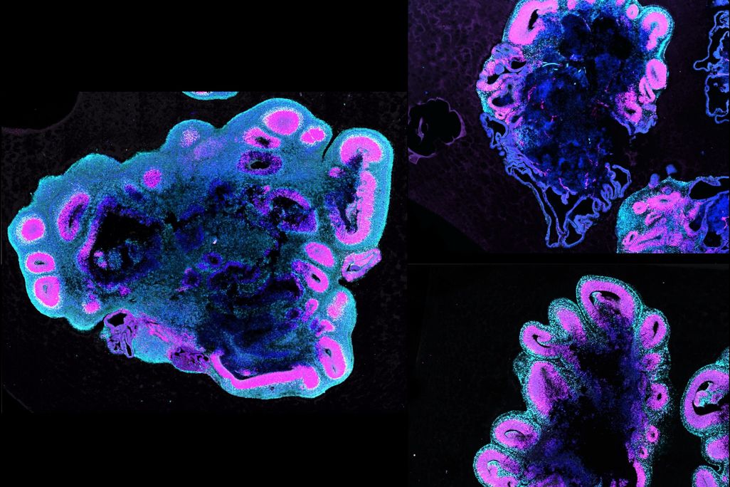 brain organoids