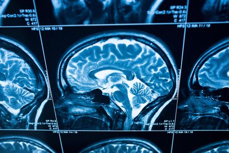 This is your brain on science.