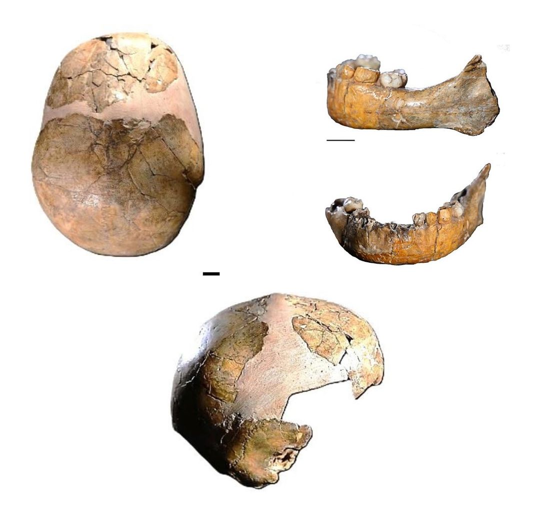 images of a damaged skull and jaw, with plaster filling in some gaps