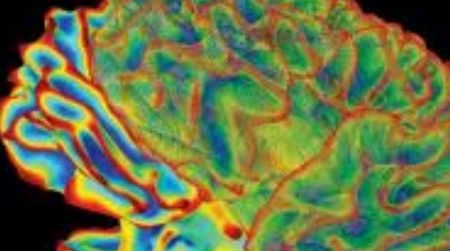 Brain research is now part of the daily news.