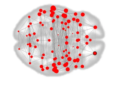 This functional connectivity map, a kind of “fingerprint” of the brain, displays how different regions interact with each other in 12-year-olds. The map was constructed from resting-state MRIs, where participants were lying down and not completing a task. Larger red circles denote brain “nodes” with more connections.