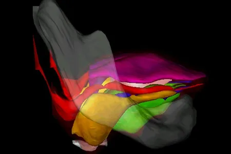 A new and improved model of the human tongue.