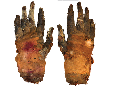 Swedish researchers used phase-contrast imaging to examine the soft tissue of a 2,400-year-old mummified hand